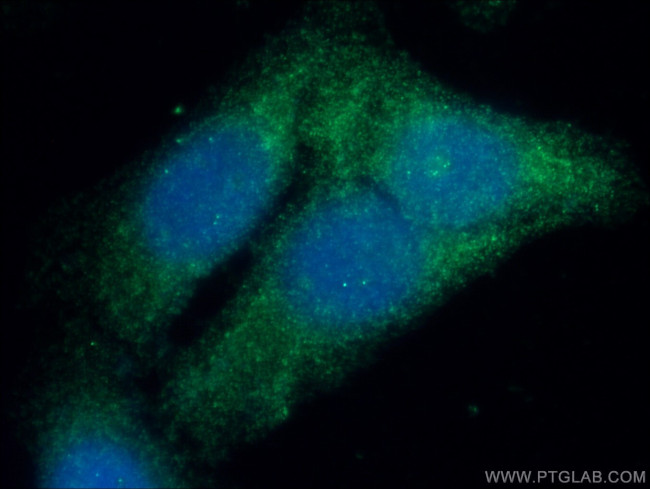 GSNOR/ADH5 Antibody in Immunocytochemistry (ICC/IF)