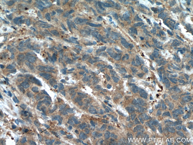 GSNOR/ADH5 Antibody in Immunohistochemistry (Paraffin) (IHC (P))