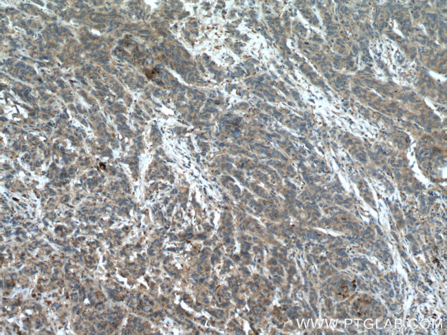 GSNOR/ADH5 Antibody in Immunohistochemistry (Paraffin) (IHC (P))