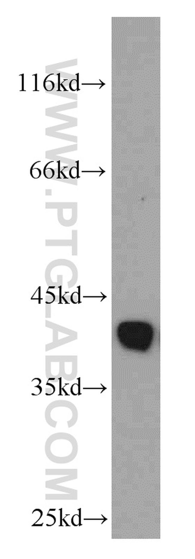 GSNOR/ADH5 Antibody in Western Blot (WB)