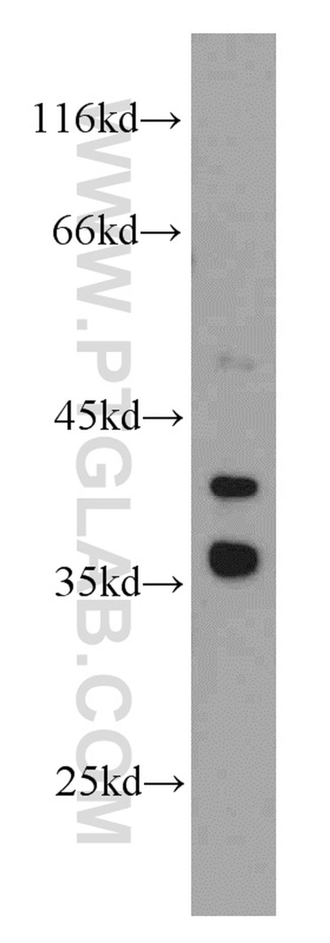 GSNOR/ADH5 Antibody in Western Blot (WB)