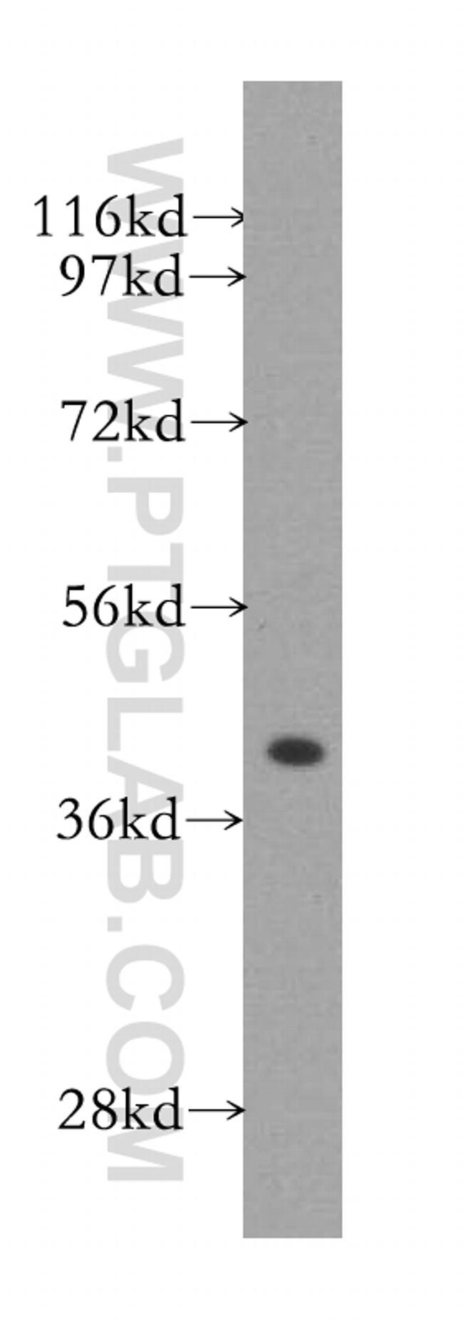 GSNOR/ADH5 Antibody in Western Blot (WB)