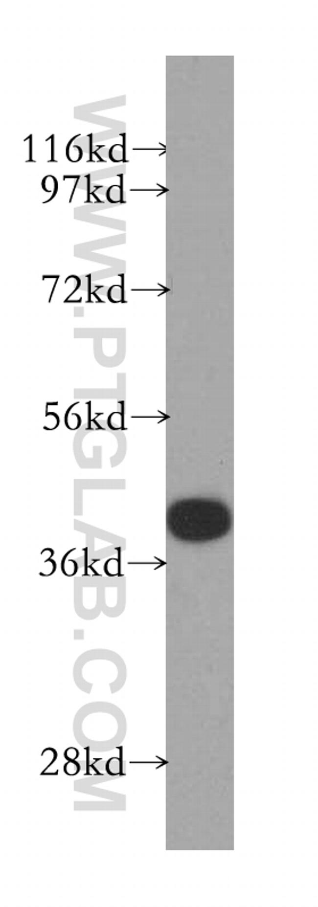 GSNOR/ADH5 Antibody in Western Blot (WB)