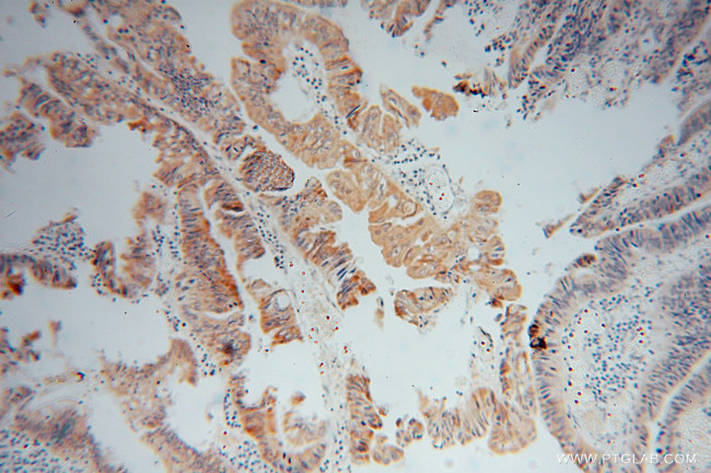 AMD1 Antibody in Immunohistochemistry (Paraffin) (IHC (P))