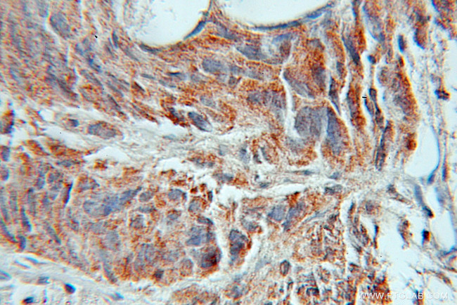 AMD1 Antibody in Immunohistochemistry (Paraffin) (IHC (P))