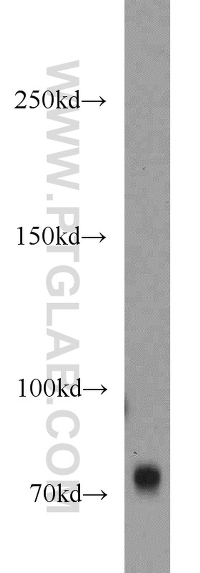 GANP Antibody in Western Blot (WB)