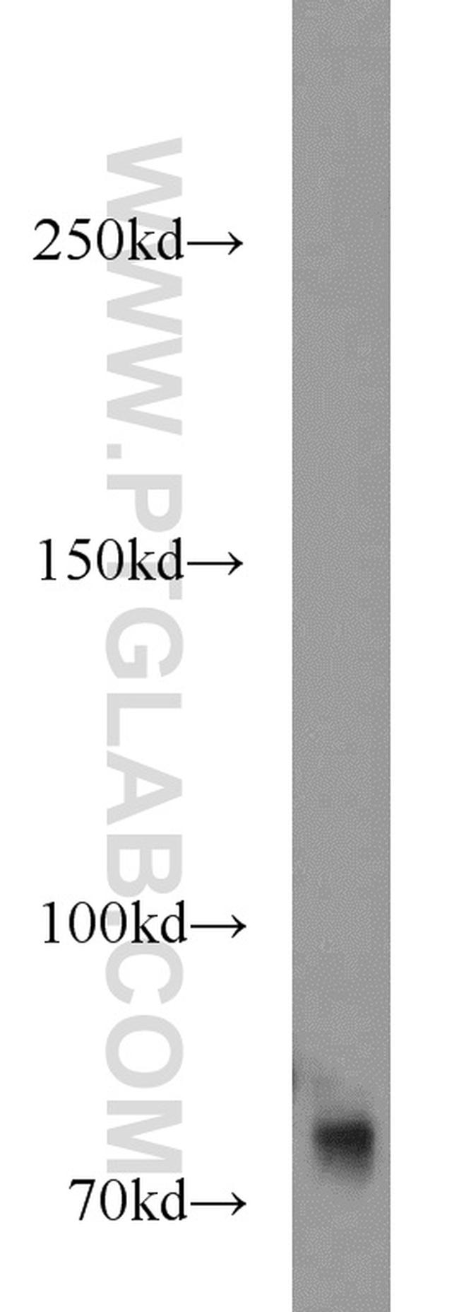 GANP Antibody in Western Blot (WB)