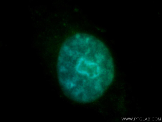 NONO Antibody in Immunocytochemistry (ICC/IF)