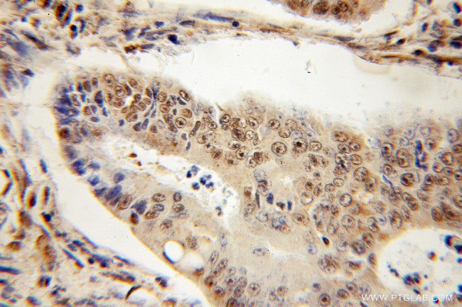 NONO Antibody in Immunohistochemistry (Paraffin) (IHC (P))