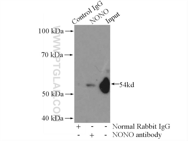 NONO Antibody in Immunoprecipitation (IP)