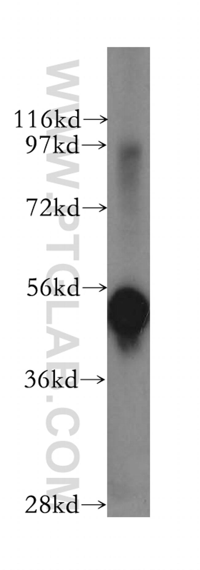 NONO Antibody in Western Blot (WB)