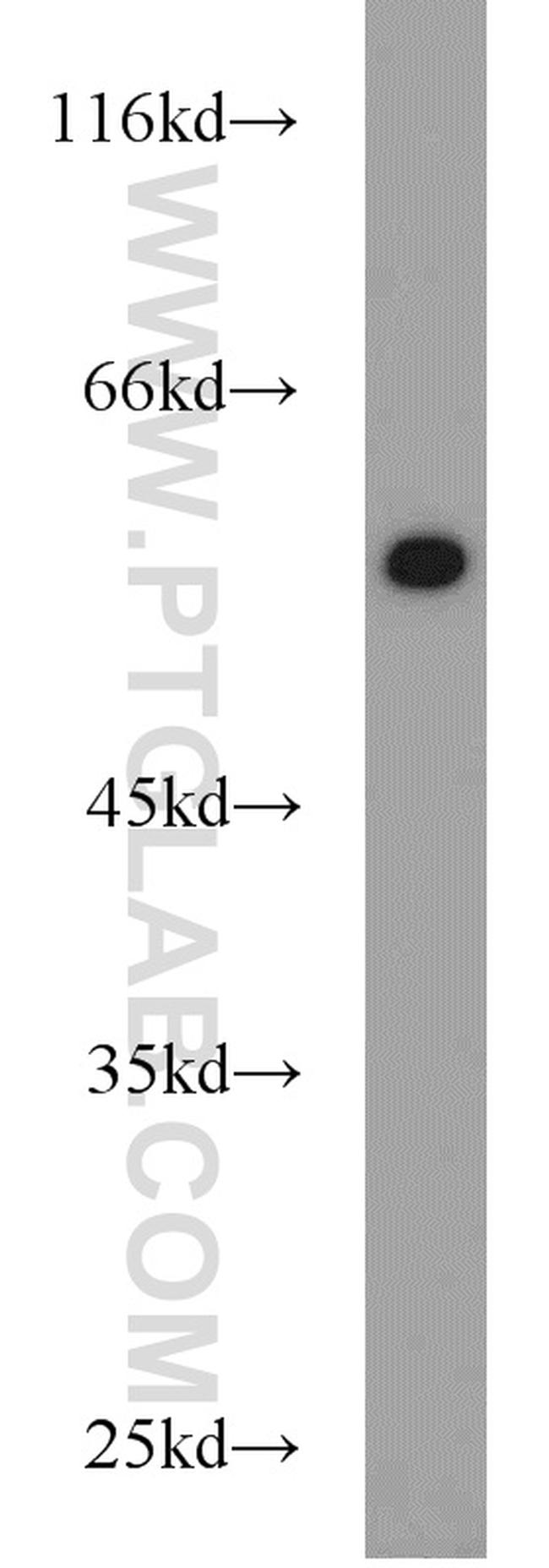 NONO Antibody in Western Blot (WB)