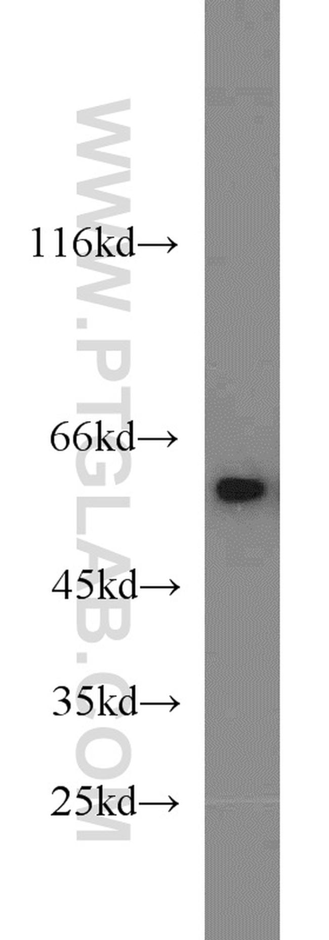 NONO Antibody in Western Blot (WB)