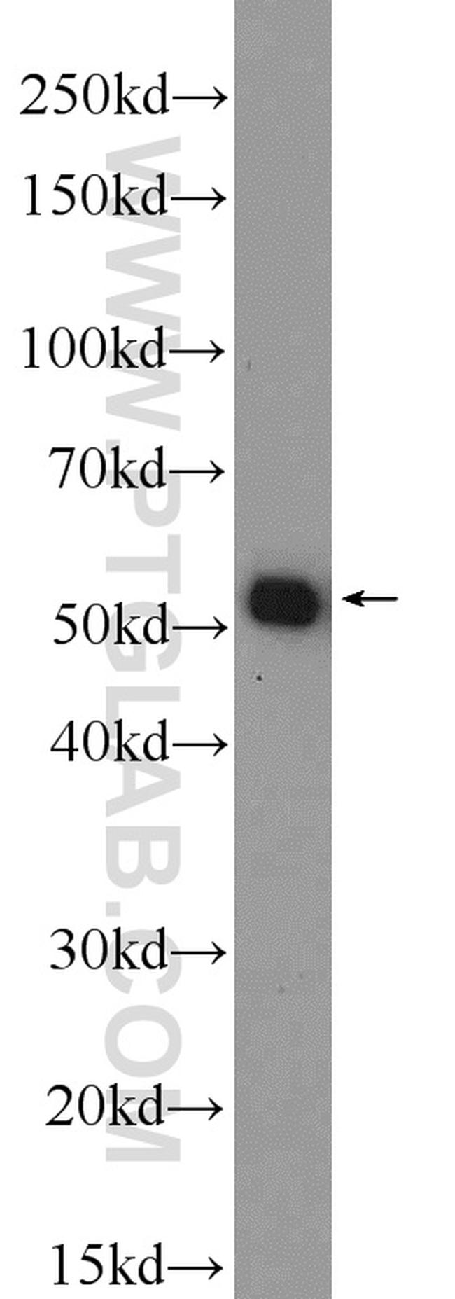 NONO Antibody in Western Blot (WB)