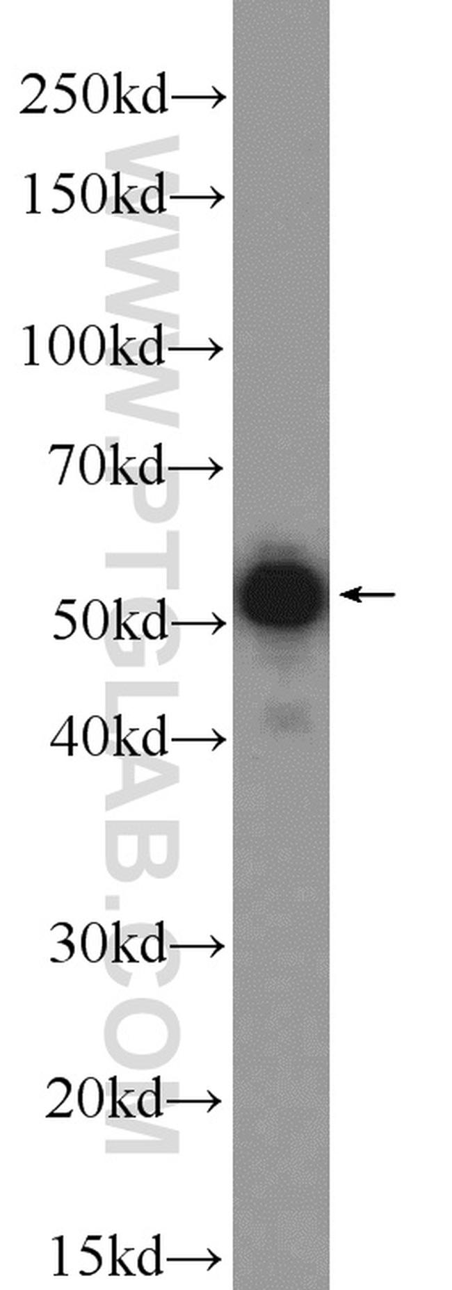 NONO Antibody in Western Blot (WB)