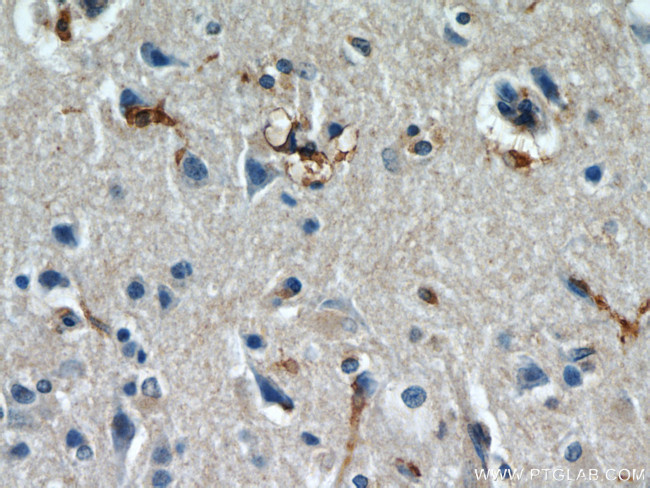 IL13RA2 Antibody in Immunohistochemistry (Paraffin) (IHC (P))