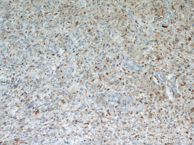 IL13RA2 Antibody in Immunohistochemistry (Paraffin) (IHC (P))