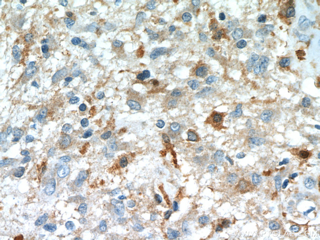 IL13RA2 Antibody in Immunohistochemistry (Paraffin) (IHC (P))