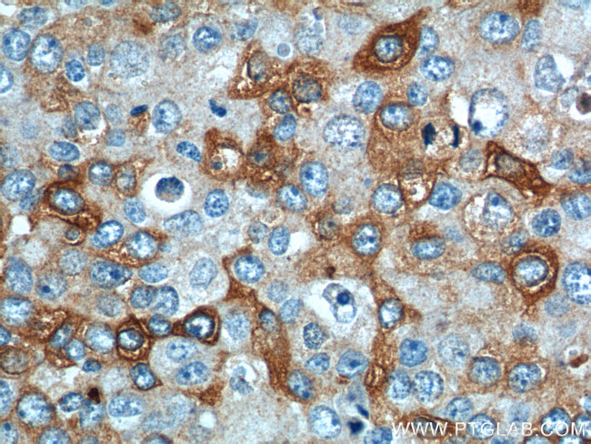 IL13RA2 Antibody in Immunohistochemistry (Paraffin) (IHC (P))