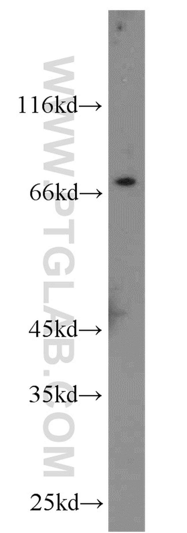 IL13RA2 Antibody in Western Blot (WB)