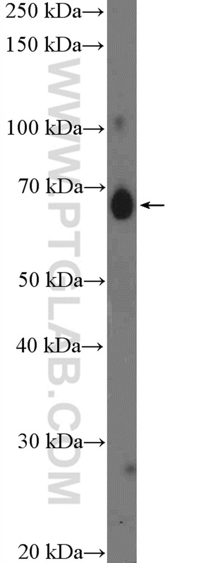 IL13RA2 Antibody in Western Blot (WB)