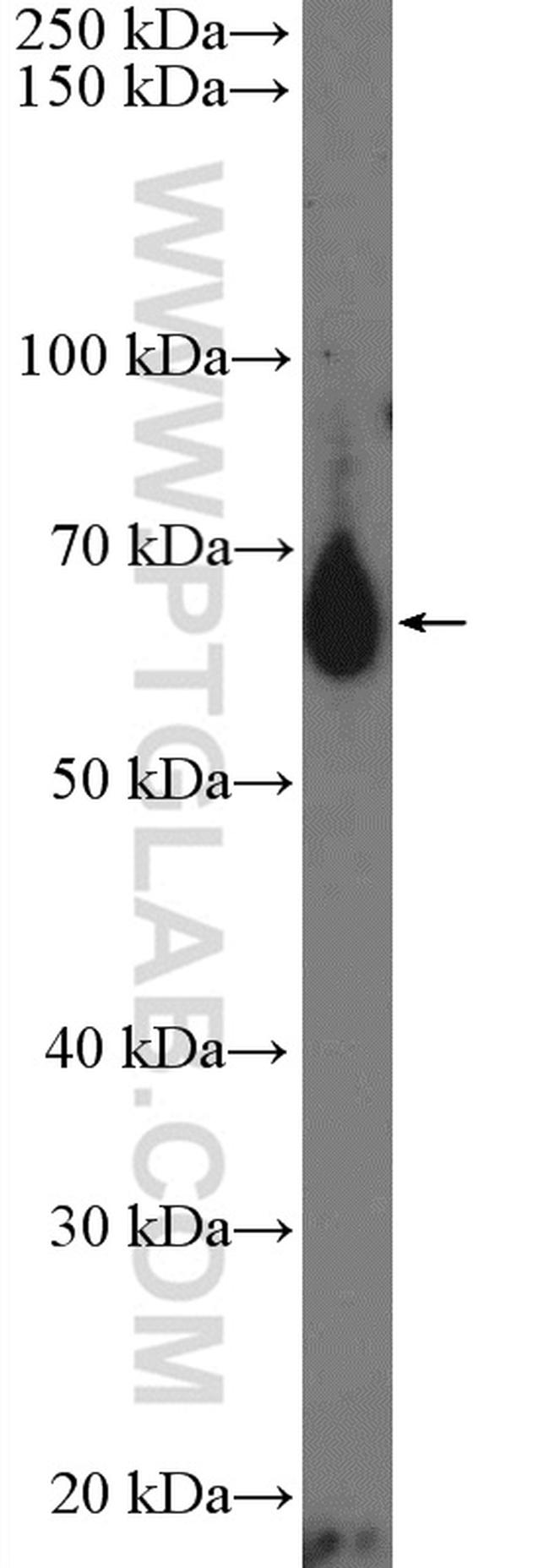 IL13RA2 Antibody in Western Blot (WB)