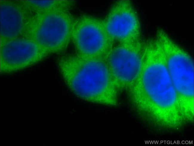 Annexin V Antibody in Immunocytochemistry (ICC/IF)