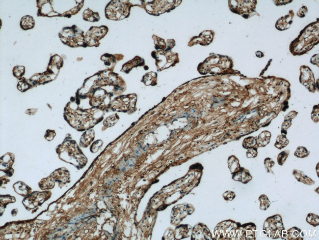 Annexin V Antibody in Immunohistochemistry (Paraffin) (IHC (P))