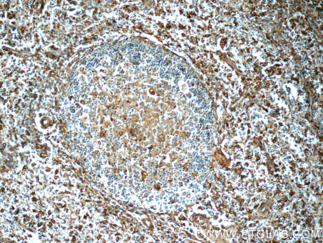 Annexin V Antibody in Immunohistochemistry (Paraffin) (IHC (P))