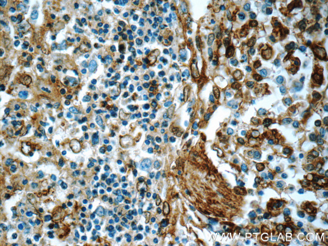 Annexin V Antibody in Immunohistochemistry (Paraffin) (IHC (P))