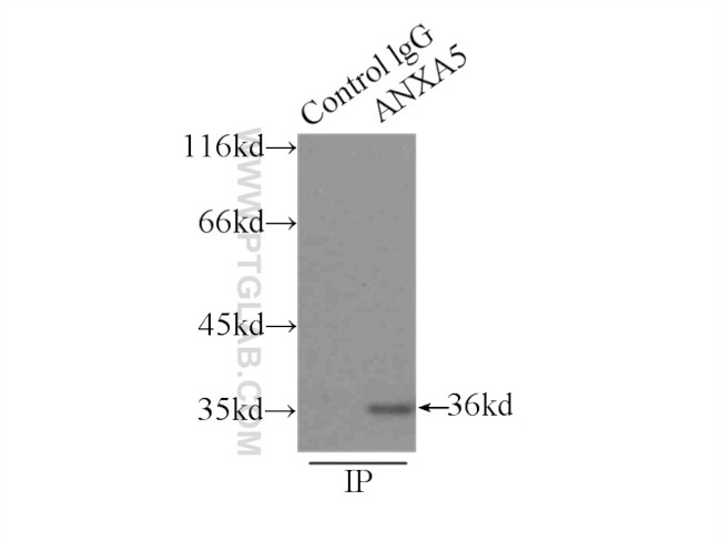Annexin V Antibody in Immunoprecipitation (IP)