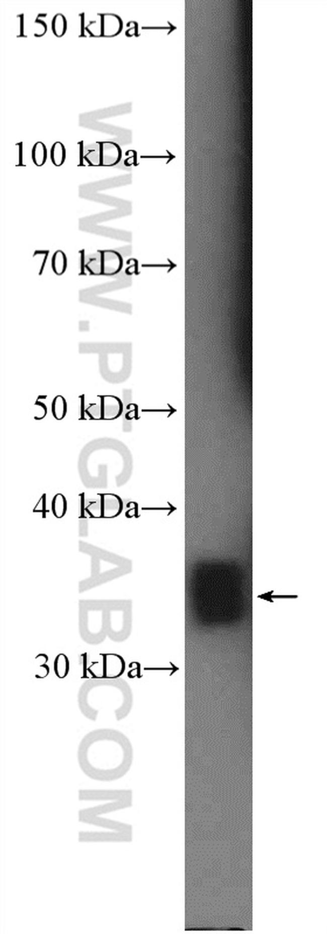 Annexin V Antibody in Western Blot (WB)