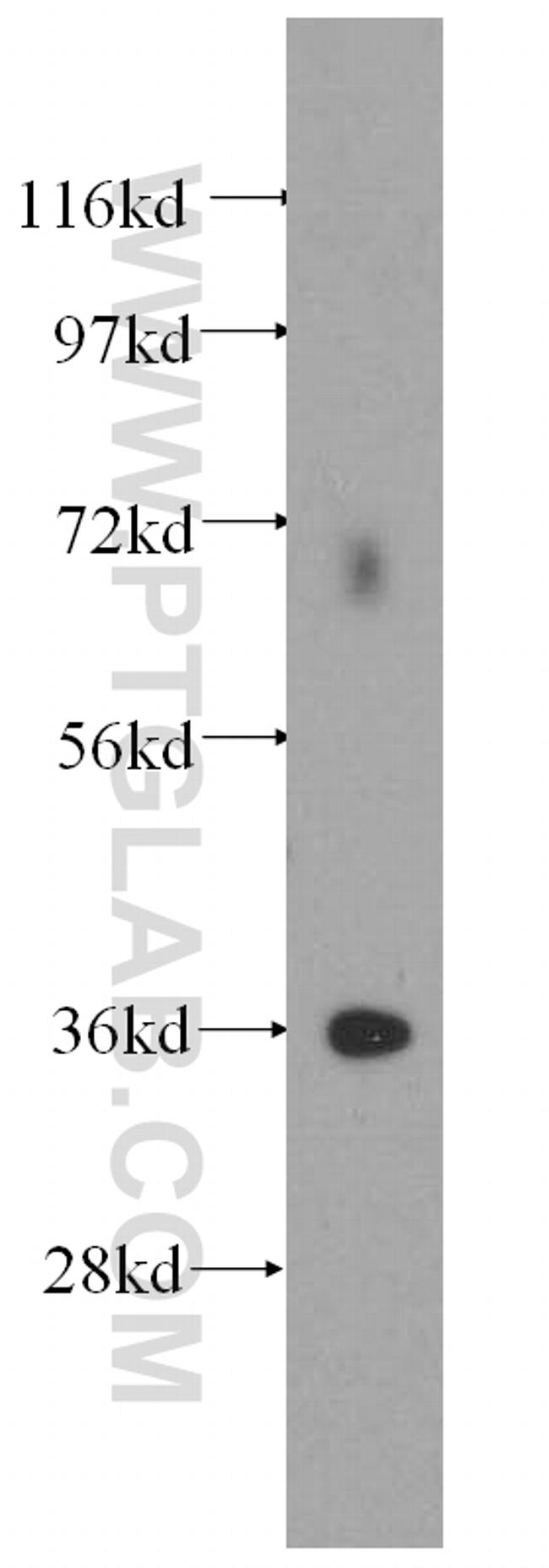 Annexin V Antibody in Western Blot (WB)