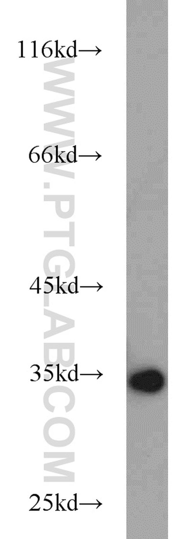 Annexin V Antibody in Western Blot (WB)