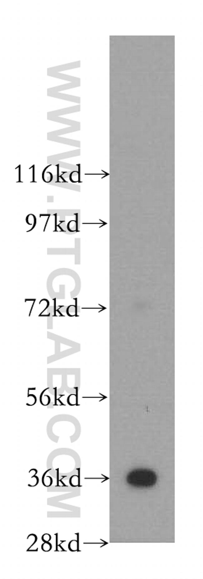 Annexin V Antibody in Western Blot (WB)