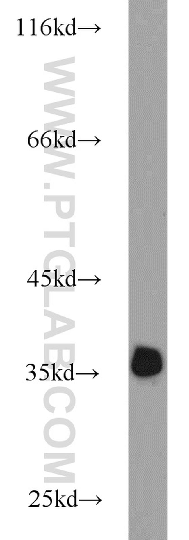 Annexin V Antibody in Western Blot (WB)