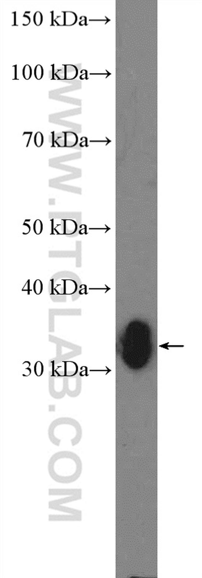 Annexin V Antibody in Western Blot (WB)