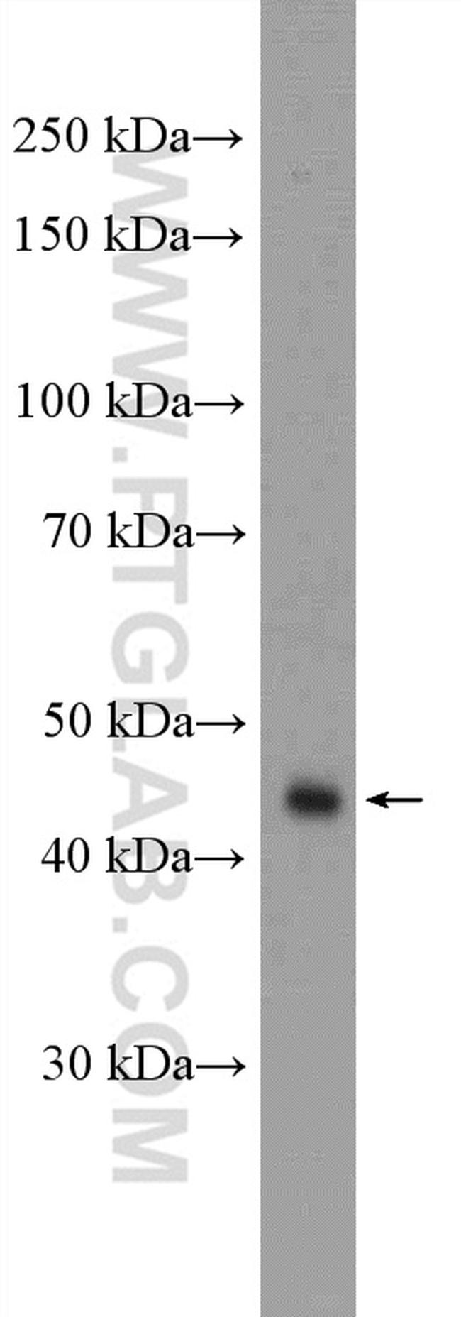 RBMS1 Antibody in Western Blot (WB)