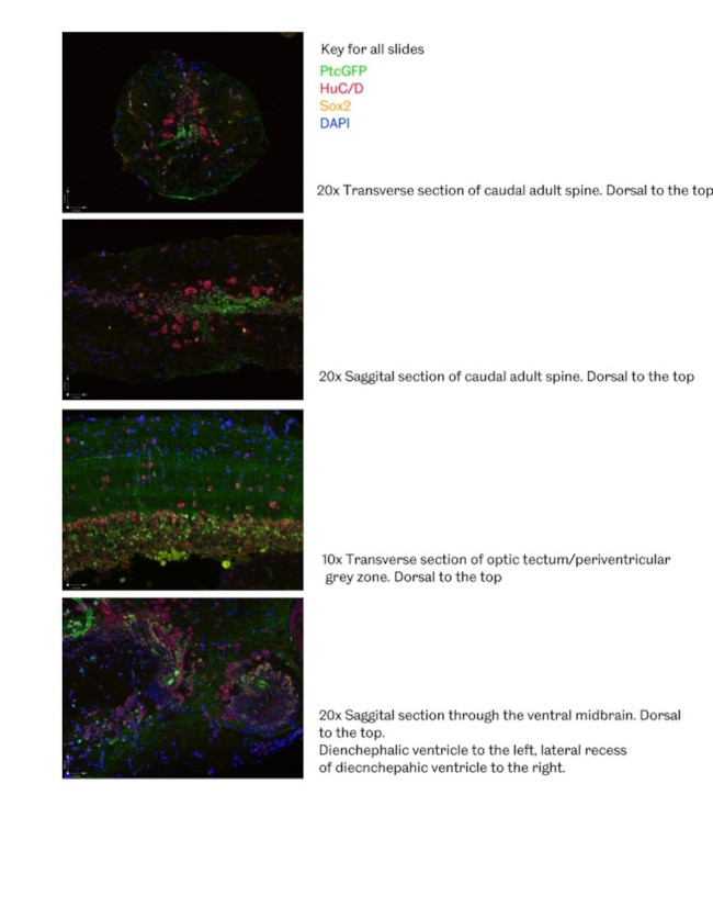 SOX2 Antibody in Immunohistochemistry (IHC)