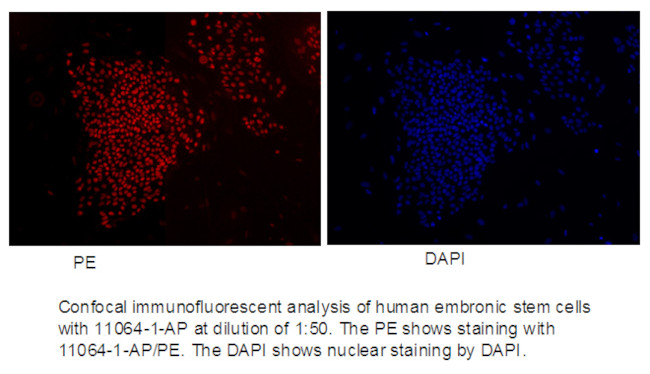 SOX2 Antibody in Immunocytochemistry (ICC/IF)