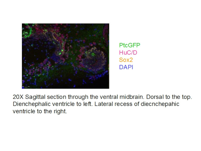 SOX2 Antibody in Immunohistochemistry (IHC)