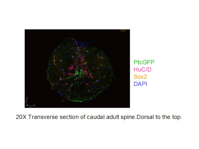 SOX2 Antibody in Immunohistochemistry (IHC)