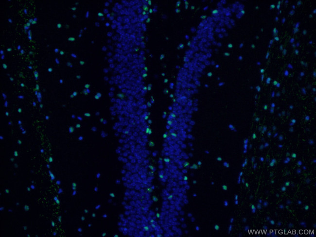 SOX2 Antibody in Immunohistochemistry (PFA fixed) (IHC (PFA))