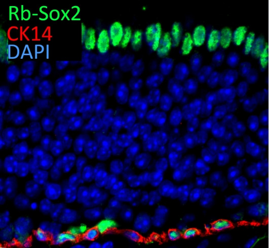 SOX2 Antibody in Immunohistochemistry (IHC)