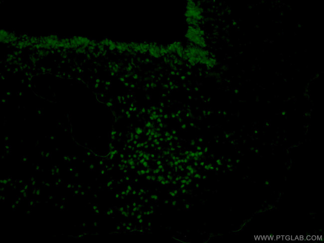 SOX2 Antibody in Immunohistochemistry (PFA fixed) (IHC (PFA))