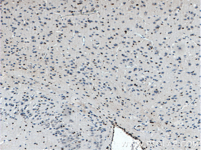 SOX2 Antibody in Immunohistochemistry (Paraffin) (IHC (P))