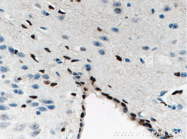 SOX2 Antibody in Immunohistochemistry (Paraffin) (IHC (P))