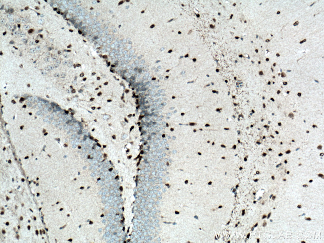 SOX2 Antibody in Immunohistochemistry (Paraffin) (IHC (P))