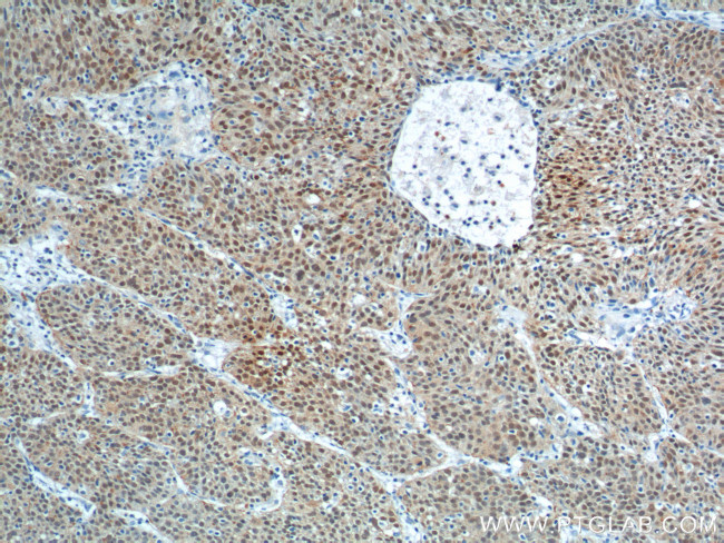 SOX2 Antibody in Immunohistochemistry (Paraffin) (IHC (P))