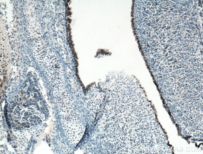 SOX2 Antibody in Immunohistochemistry (Paraffin) (IHC (P))